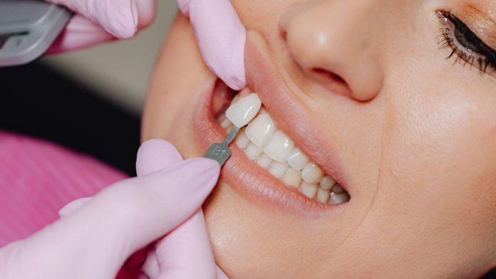 denture clinic oshawa