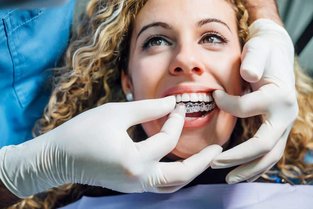 Invisalign Express