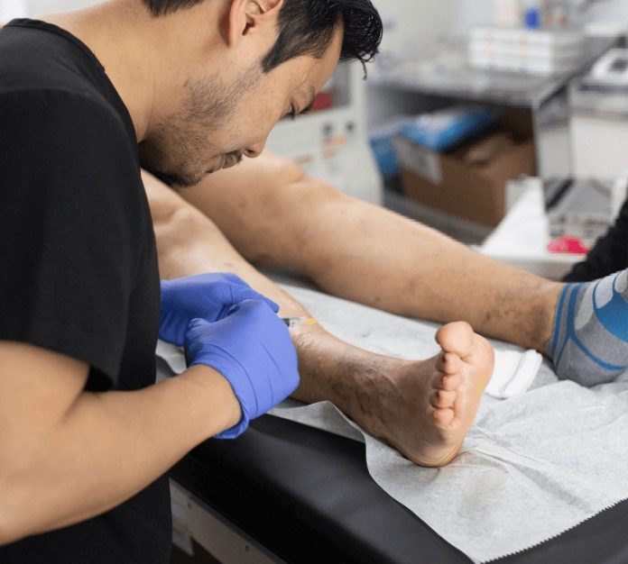 California Vein Experts