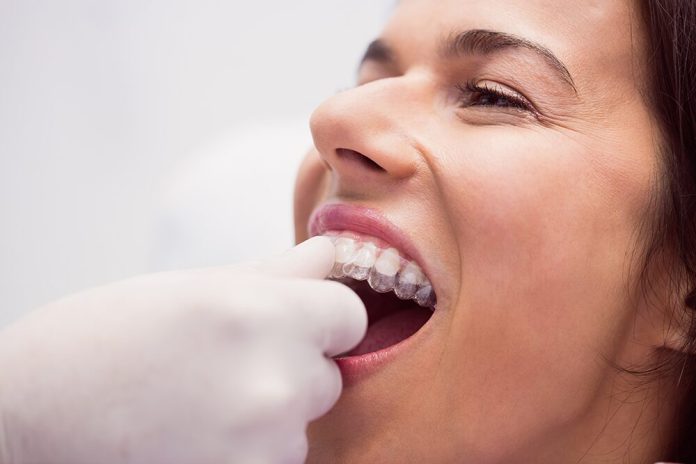 invisible teeth straightening