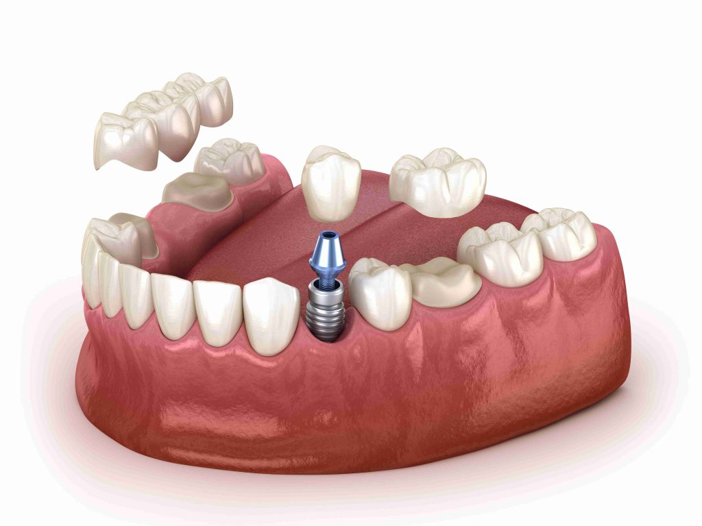 Image Source -Directory dental Liverpool