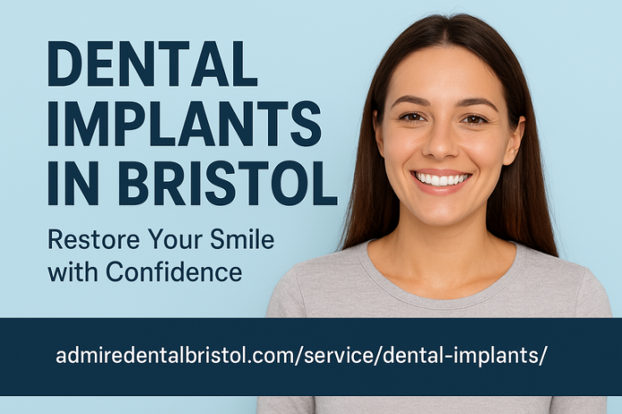 Dental Implants in Bristol