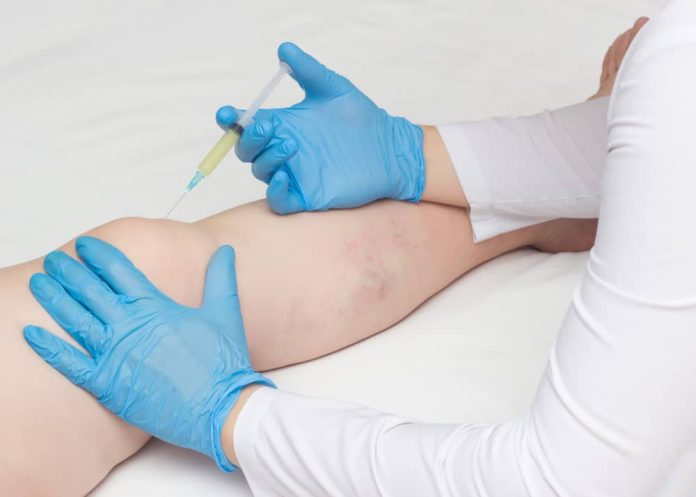 Who Is the Best Knee Pain Doctor in the Financial District?