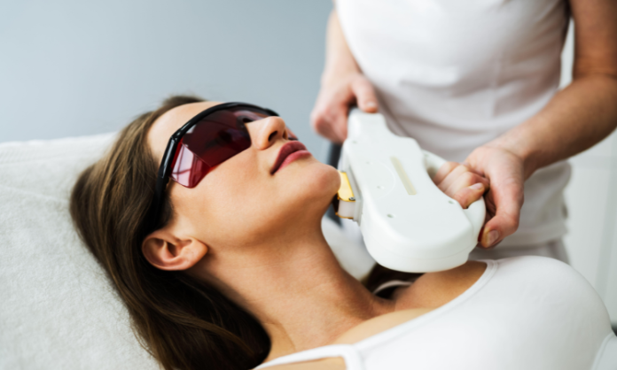 IPL Photofacial in Arlington