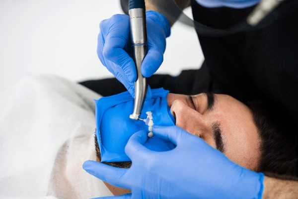 invisalign Ashford

