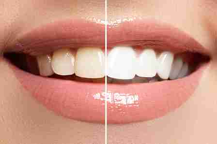 Teeth