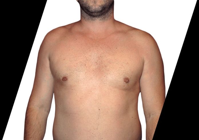 body contouring surgery houston