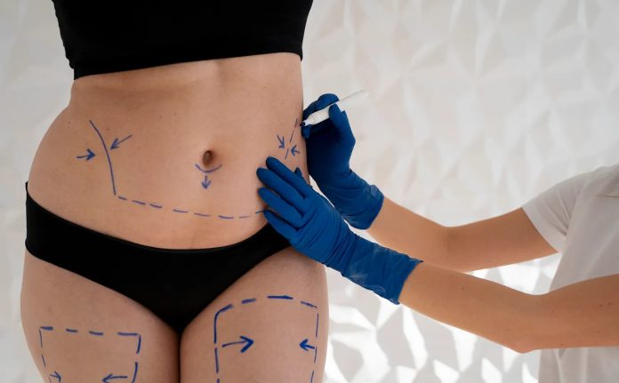 Fat transfer in dubai