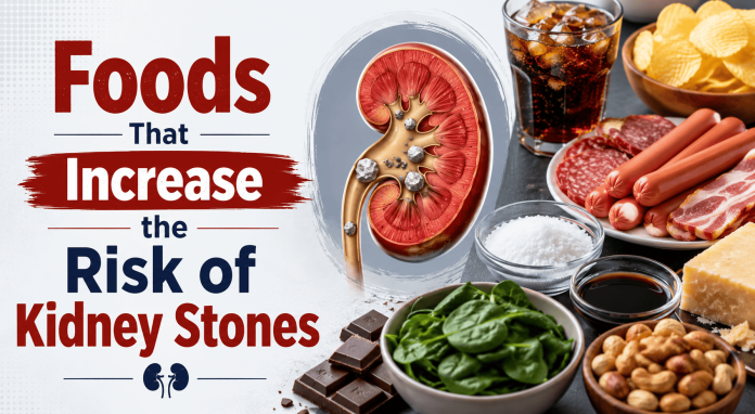 Foods That Increase the Risk of Kidney Stones