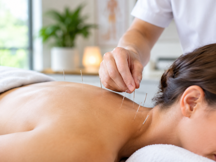 Acupuncture Treatment Middle Tennessee