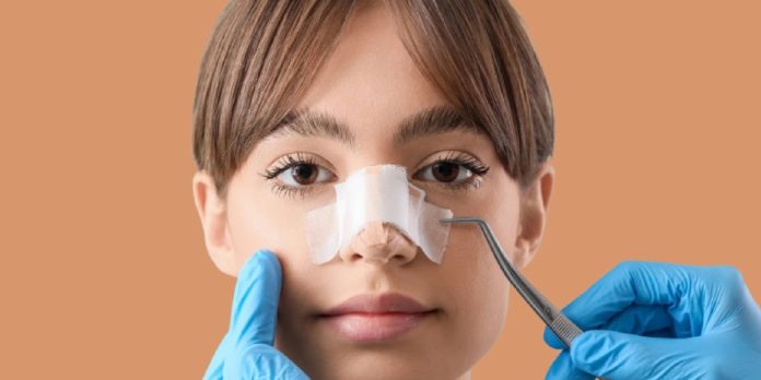 Septoplasty in Dubai